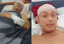 APH Di Minta Usut Tuntas: Terkait Wartawan Yang Sedang Bertugas Meliput Tambang Galian C Tuban, Di Serang oleh Empat Preman